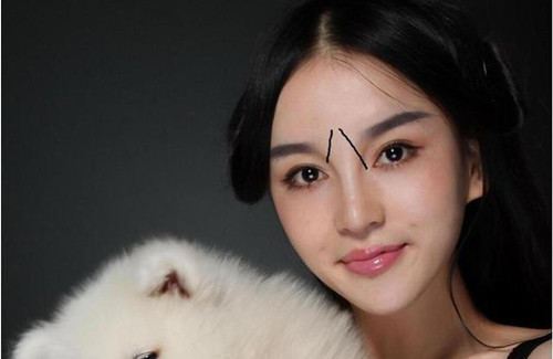 女人眉间八字纹面相好不好图文
