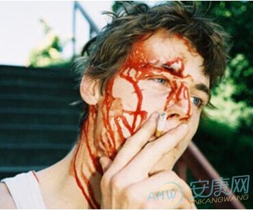 2、夢見自己生了兒子,兒子頭上的傷口流血是什麼意思?