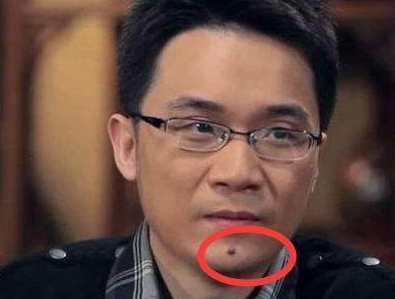 下巴有痣看命运下巴有痣是好是坏