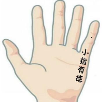 手指长痣的寓意哪根手指长痣桃花多