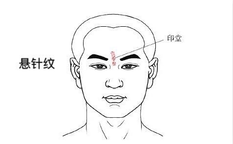 女人悬针纹面相好不好印堂面相解析