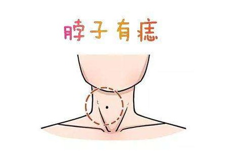 脖子有痣的说法大全
