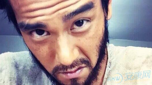 额头有横纹的男人面相如何图文