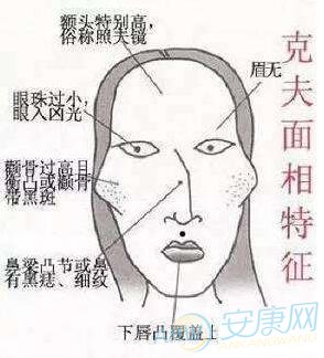 其中这样的面相在面相学中非常不好,预示着会嫁二婚的男人,有子女的