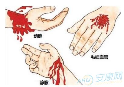 正确解读梦见自己手腕流血的象征含义(图文)