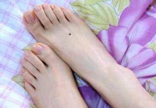 脚底有痣是人上人之相脚上各部位痣相命理详解