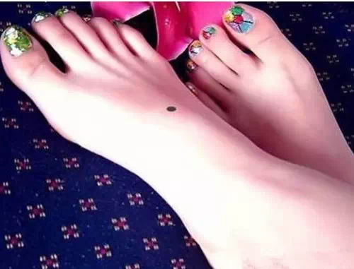 痣的位置与命运图解27图