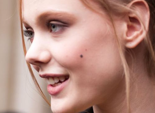 媒婆痣算美人痣吗不算啊