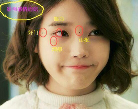 3,影响财运的:鼻头痣,鼻翼痣,嘴角痣.