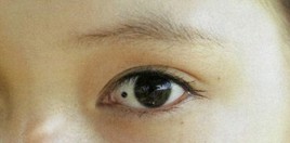 脸上、手上的痣看你命运【图解】 脸上、手上的痣看你命运「图解」