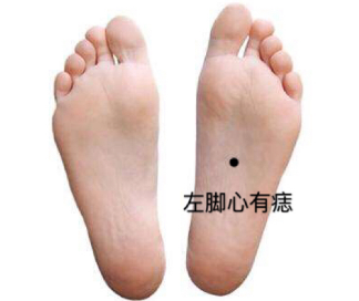 据说左脚脚下长痣,说明你非富即贵!女人脚底有痣,应该是贵人之相.