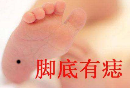脚底有痣代表什么,脚底有痣图解大全 脚底有痣代表什么,脚底有痣图解大全