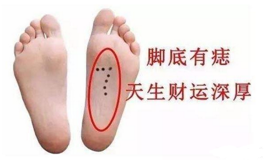 脚下有痣代表什么男人女人脚底有痣详解