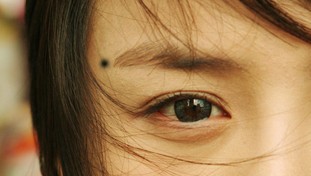 脸上、手上的痣看你命运【图解】 脸上、手上的痣看你命运「图解」