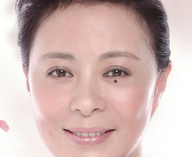女人脸上46处痣的吉凶组图