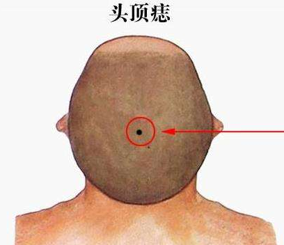 身上痣的位置与命运图解痣相解人生