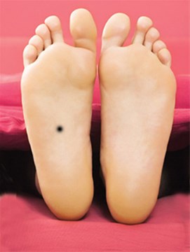 脚底长痣主富贵如果有的话可千万别点掉