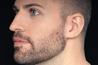 耳朵软意味着什么