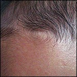 额头有旋代表什么额头发旋算命