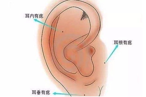 耳朵上长痣的含义