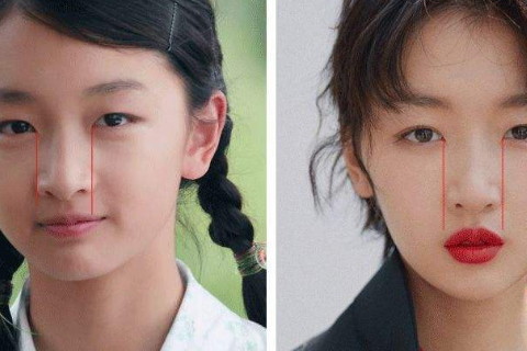 如果鼻子出现了漏孔并且鼻梁有突出特点的话,加上鼻头和鼻梁会好像刀