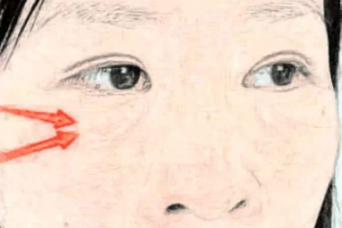 眼角下垂的女人面相如何