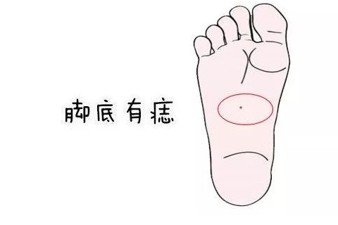 脚底板长痣的痣相图解