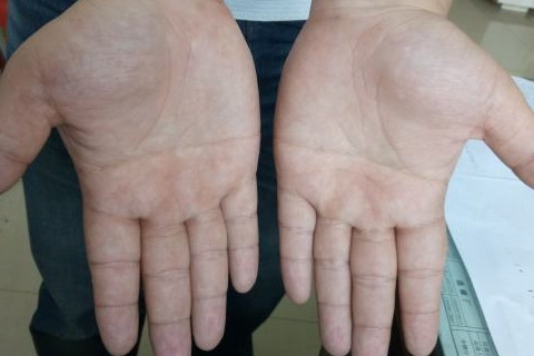 男人双手断掌意义是什么