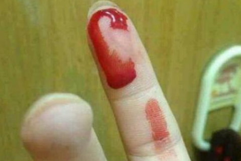 梦见手背被割伤流血