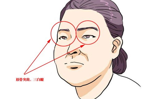 女人眉骨高面相说明了什么