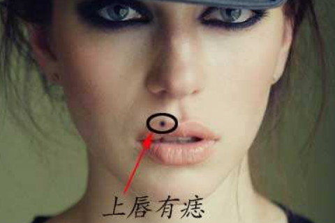嘴唇上长痣代表什么图片
