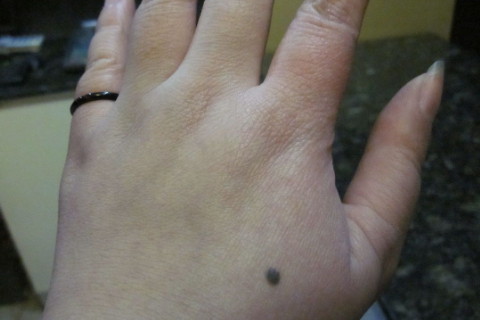 手背上有痣的人一定大富大贵吗