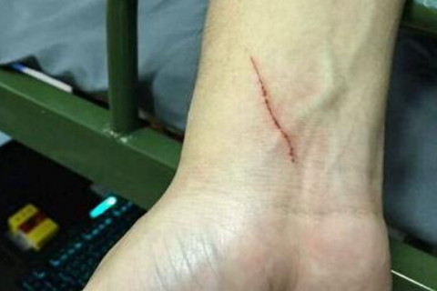 梦见被猫抓伤还流血