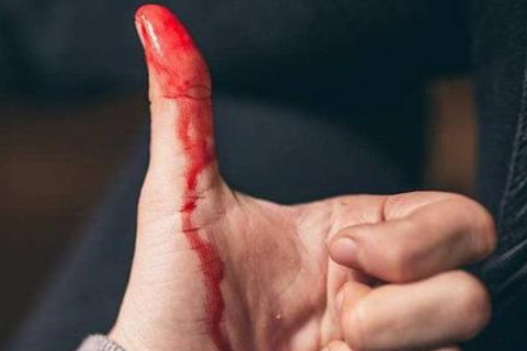 梦境的深意，解析梦见自己被杀见血的神秘寓意