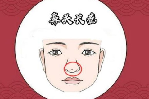 鼻子长痣有什么说法