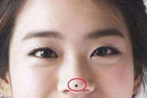 女人鼻子上的痣图解