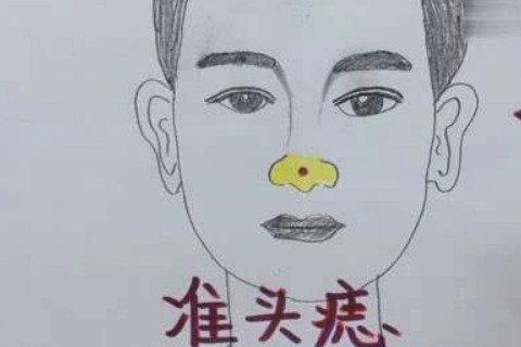鼻上有痣面相详解
