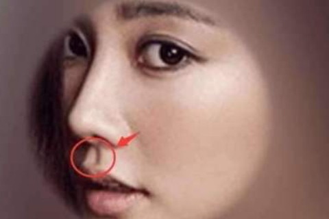 人中浅的女人面相如何