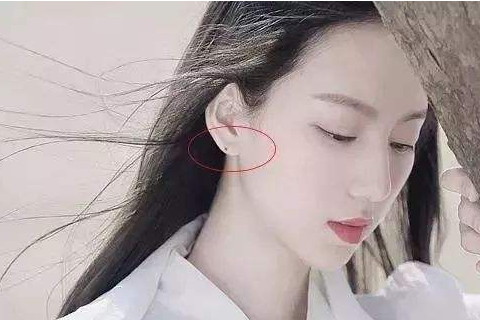 女人耳朵痣图片