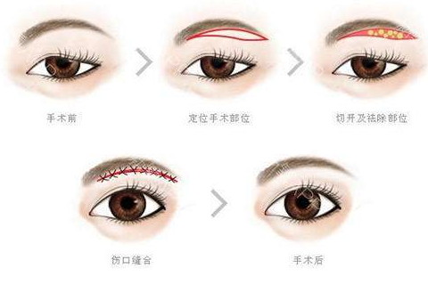 倒八字眉的女人面相好不好