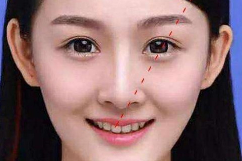 女人招风耳面相运势