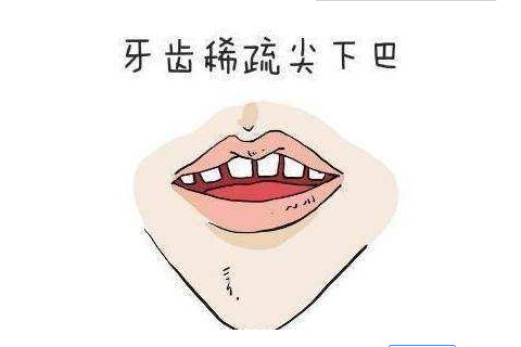 牙齿稀疏面相好不好