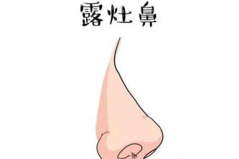 面相分析鼻梁高的人好不好