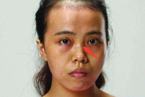 四种命苦的女人面相看你是不是