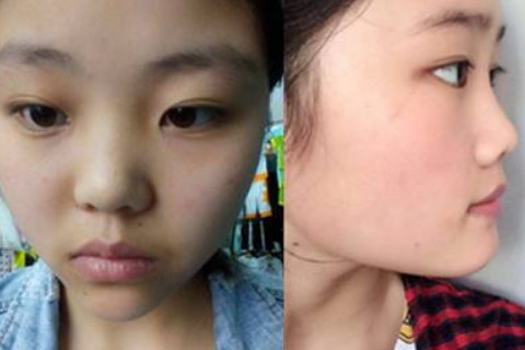 塌鼻子的女人命运如何