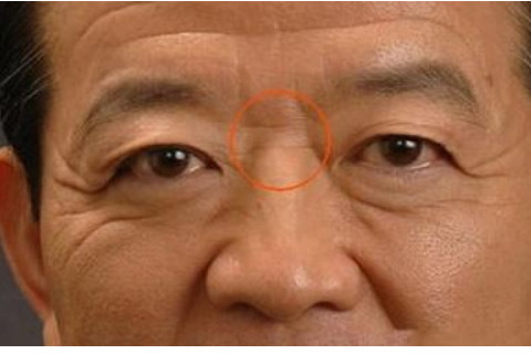 额头凸起面相分析好不好