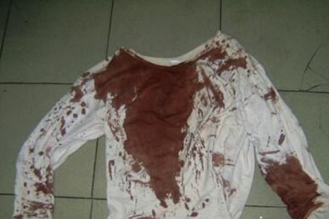 梦见自己满衣服血渍