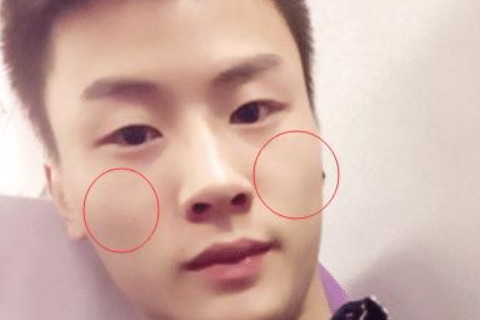 男人嘴歪面相如何