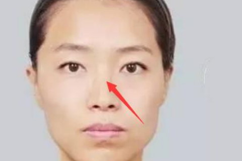 鼻梁塌陷面相代表了什么运势