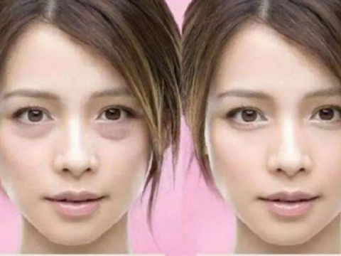 眼睛凹陷的女人面相